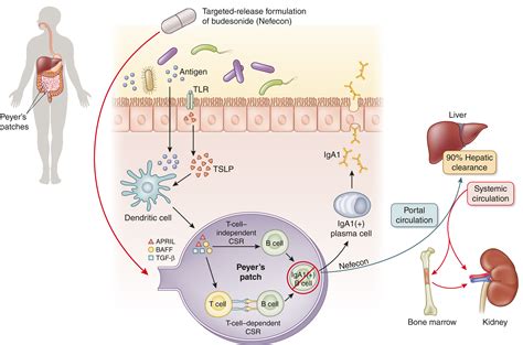 A Disease Modifying Approach To The Treatment Of Iga Nephropathy