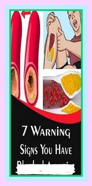 Here Are Warning Signs You Have Blocked Arteries Betty Knight Artofit