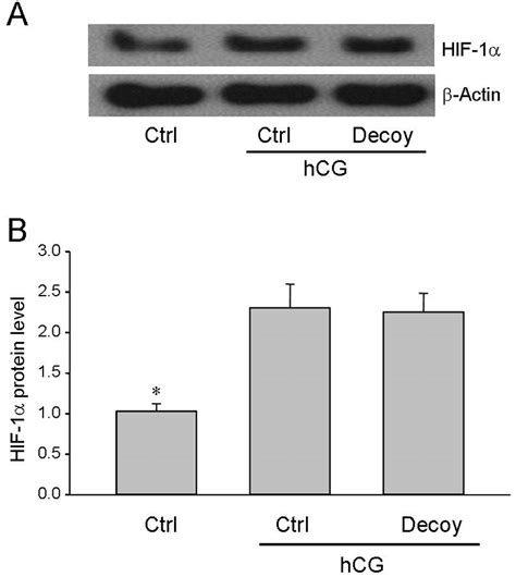 Effects Of Hif Decoy Odns Transfection On Hif Expression In