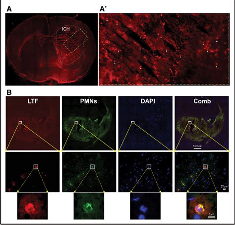 Figure 1 From Beneficial Role Of Neutrophils Through Function Of