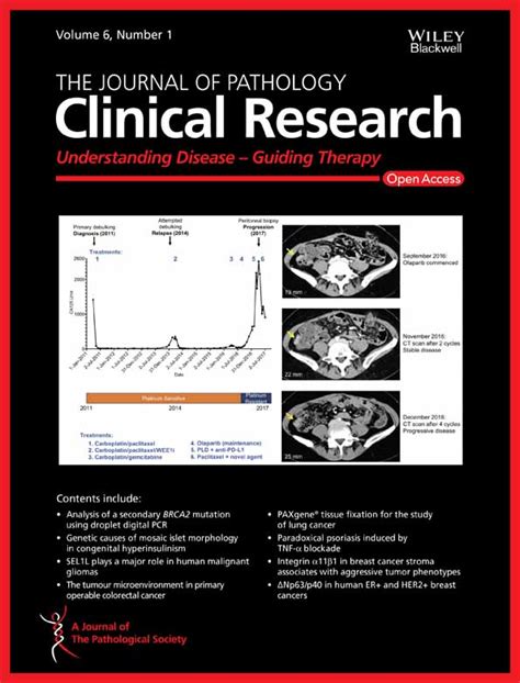 Paradoxical Psoriasis Induced By Tnf‐α Blockade Shows Immunological Features Typical Of The