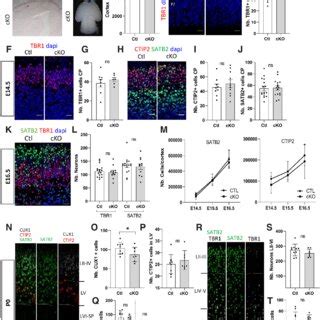 Cdc B Loss Of Function Triggers A Transient Increase Of Neuronal