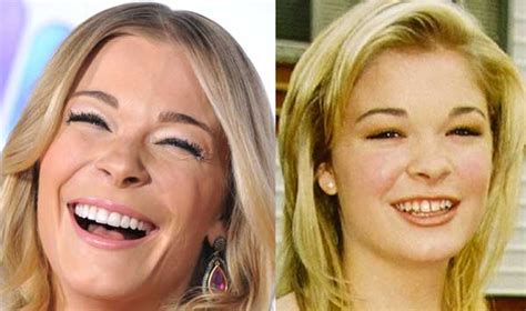 Leann Rimes Before And After New Teeth Photo Suing Emotional And