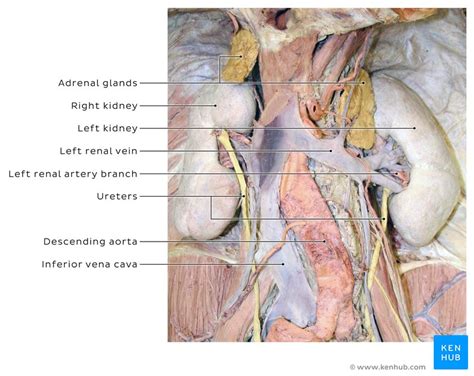 Horseshoe kidney transplantation: Anatomy and images | Kenhub