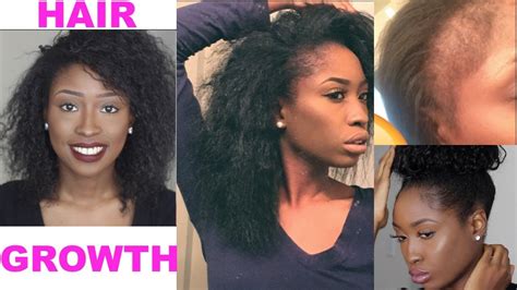 Natural Hair Growth Products - fashionnfreak