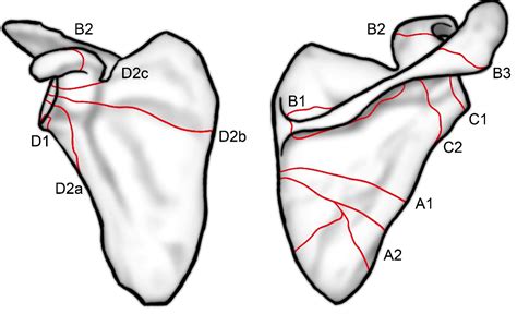 The Armdoc Scapula Body And Glenoid Fossa Fractures