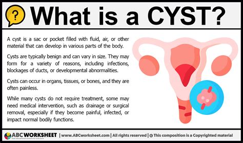 What is Cyst | Definition of Cyst