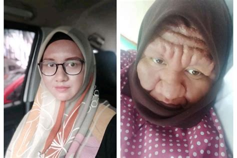 Hamil Ke Tiga Wajah Wanita Cantik Ini Malah Berubah Menjadi Bengkak