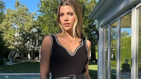 Sofia Richie talked about the bizarre reactions after she suffered black eye: ‘That’s a bad idea’