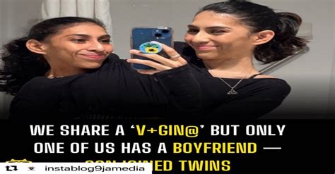 We share a ‘v+gin@’ but only one of us has a boyfriend — Conjoined