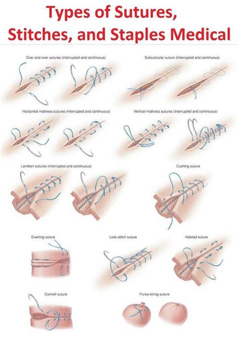 Oren Gottfried Md On Twitter Some Basic Suturing Techniques To Know