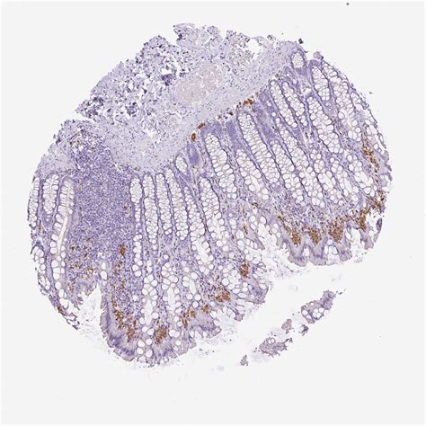 Tissue Expression Of Cd68 Staining In Colon The Human Protein Atlas