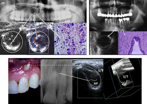 Endodontic Imaging Techniques at Susan Jaimes blog