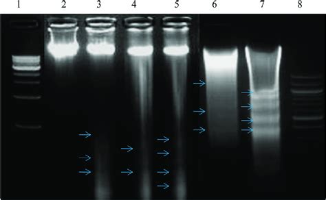 Detection of DNA fragmentation by agarose gel electrophoresis (2%). The ...