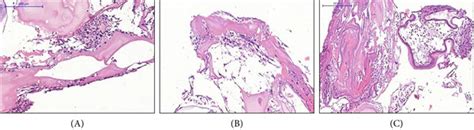 Uc Msc Osteogenic Differentiation On The Orthoss Scaffold A A Download Scientific Diagram