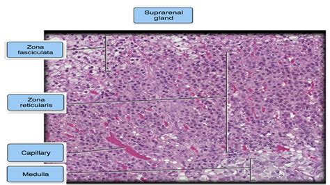 [Solved] Label the photomicrograph based on the hints provided. Medulla ...