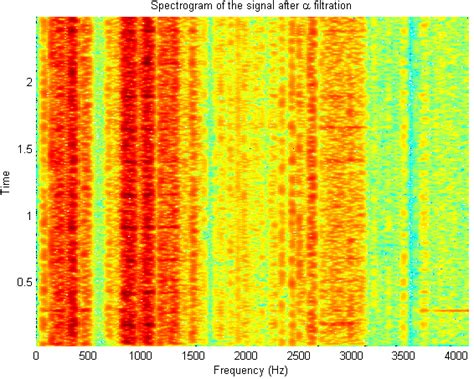 Spectrogram Of The Filtered Signal Fig 6 Waveform Of The Filtered Download Scientific