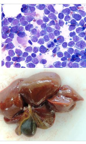 Hepatobiliary And Exocrine Pancreas 4 Flashcards Quizlet