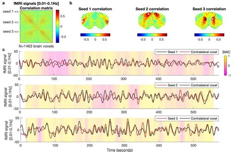 Typical Resting State Functional Connectivity Analysis In Band Pass