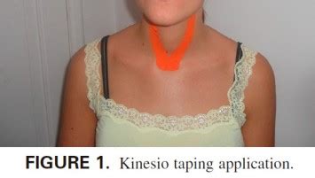 Aplicaci N De Kinesiotaping En La Disfon A Temtex Espa A