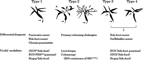 The cholangiographic classification of IgG4-related sclerosing ...