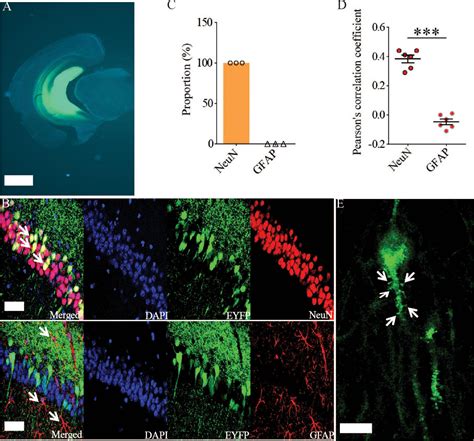 Frontiers Inhibition Of Rac In Ventral Hippocampal Excitatory