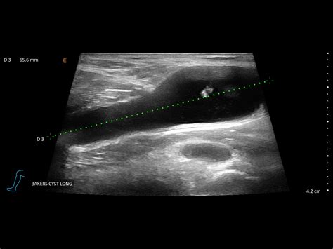 Diagnostic Ultrasound Richmond Physiotherapy