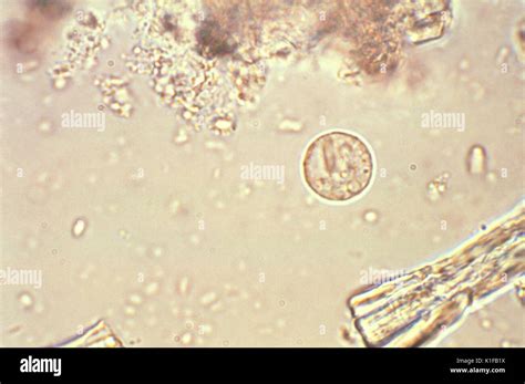 Entamoeba Histolytica Trophozoite In Stool