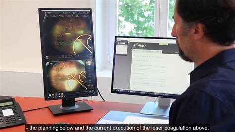 Navilas Modern Teleguidance Concepts For Navigated Retinal Laser In