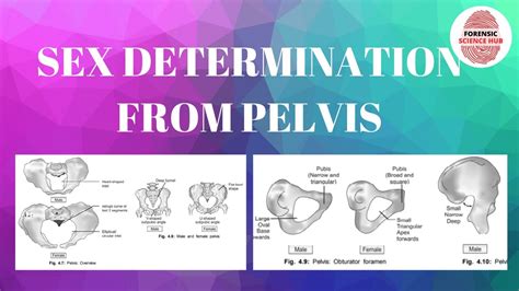 Sex Determination Through Pelvis Forensic Medicine Youtube