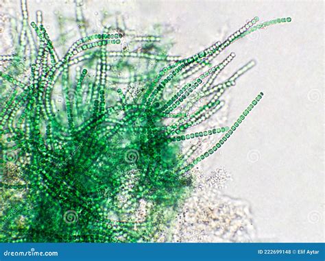 Nostoc Sp. Algae Under Microscopic View, Cyanobacteria, Blue Green ...