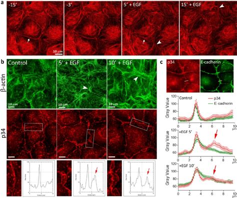 Reorganization Of The Actin Cytoskeleton In Iar Cells Treated With