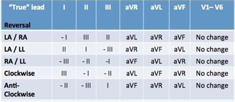 Ecg Limb Lead Reversal Litfl Ecg Library Diagnosis