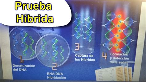 Prueba de híbridos PCR VPH YouTube