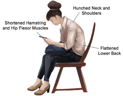 Focus On Improving Your Posture Cumberland Physiotherapy Sport