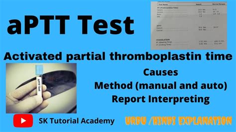 Activated Partial Thromboplastin Time APTT Test YouTube