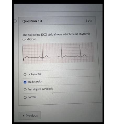 Solved Question Ptsthe Following Ekg Strip Shows Which Chegg