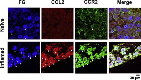 Chemokine C C Motif Ligand Ccl And Chemokine C C Motif Receptor