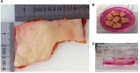 Frontiers An Ex Vivo Human Skin Model To Study Superficial Fungal