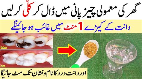 Add Home Ingredient In Water And Get Rid Of Teeth Cavity Toothache