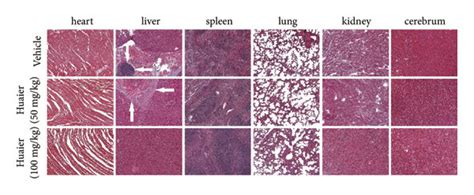 HBE Suppresses The Growth And Metastasis Of MNK74 Orthotopic Tumors