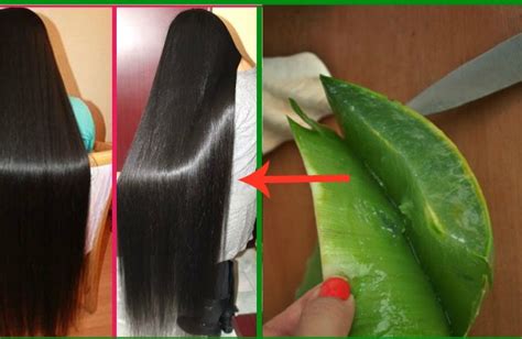 5 Aloe Vera Hair Masks For Hair Growth