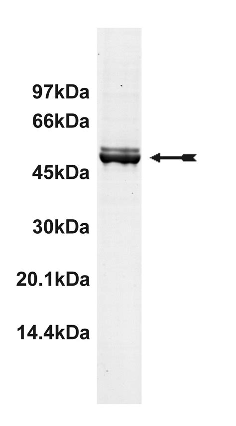 Eurofins Discoverx Tlk Protein Active Quantity G Fisher Scientific