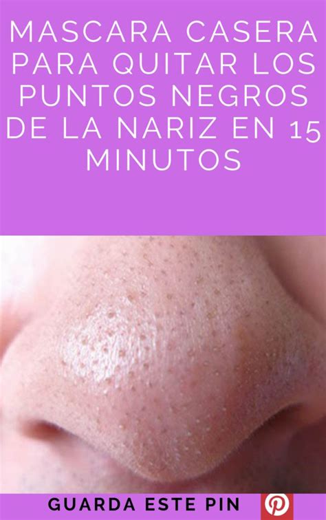 Mascara Casera Para Quitar Los Puntos Negros De La Nariz En 15 Minutos