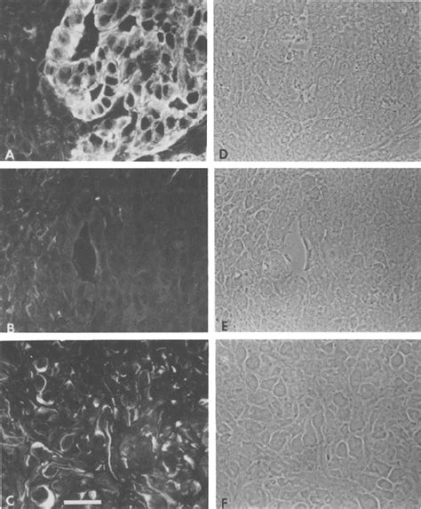 Immunofluorescence Microscopy Of Frozen Sections Of Rabbit Bladder