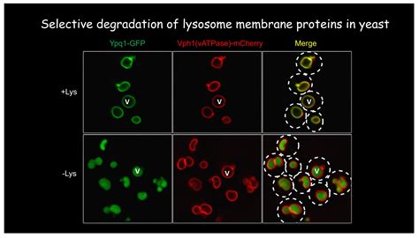 A Ubiquitin And Escrt Dependent Pathway Regulates Lysosome Membrane