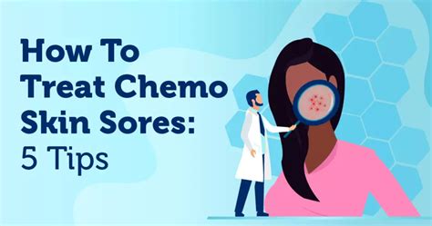 How To Treat Chemo Skin Sores: 5 Tips | MyBCTeam