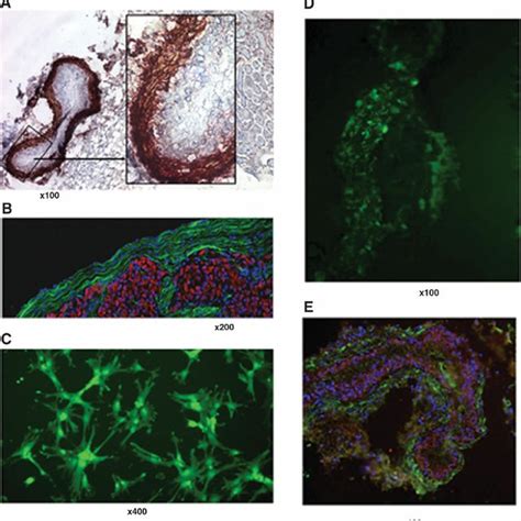 Hepatic Stellate Cell Hsc Isolation And Activation A Hscs Were Download Scientific Diagram