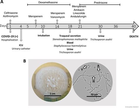 Possible Trichosporon asahii urinary tract infection in a critically ill COVID-19 patient ...