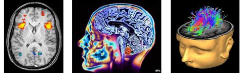 Fmri Vs Mri Psychology Sale Off-64% | www.gbu-presnenskij.ru